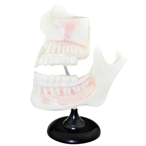 Zahnmodell – 6-fach Vergrößertes Kindergebissmodell – Naturwissenschaftliches Lehrmodell Zahnfleisch Standard-Demonstrationswerkzeug, Medizinische Lehrhilfe von VERIMP