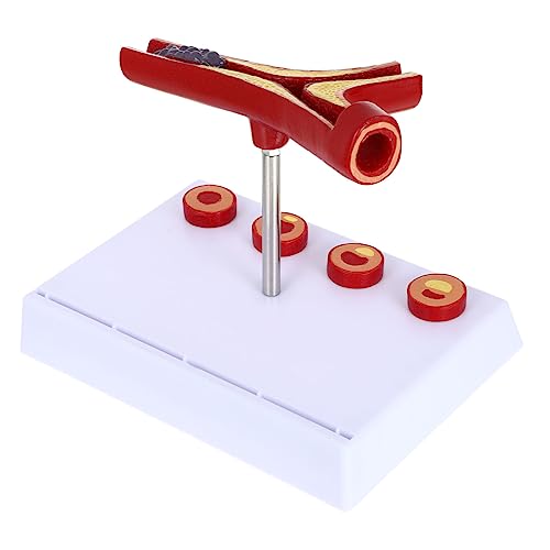 VILLFUL Atherosklerose-modell Aus Anatomisches Blutgefäßmodell Für Medizinische Und Schulische Lehre Realistisches Kardiovaskuläres Modell Für Anatomie Und Physiologie Langlebig Und Detailgetreu von VILLFUL