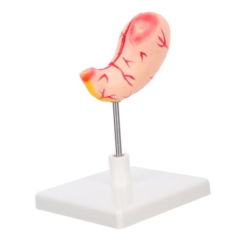 VILLFUL Detailliertes Menschliches Magenmodell Anatomisches Lehrmodell für Medizinische Ausbildung und Realistische Darstellung Des Verdauungssystems Einfach Montierbar Langlebig und von VILLFUL