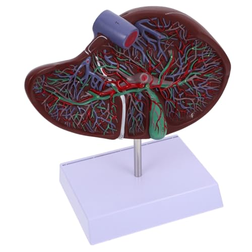 Warmhm Medizinisches Anatomisches Lebermodell mit Basis Realistisches Lehrmodell für Menschliche Leberstruktur für Universitäten und Ausbildungseinrichtungen von Warmhm