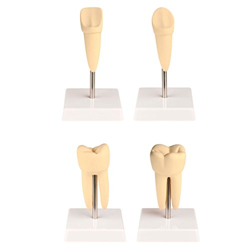 Zahnmodelle - Die vier Zahnarten im Vergleich - Schneidezahn, Eckzahn, Vormahlzahn und Mahlzahn | Wiemann Lehrmittel von Wiemann Lehrmittel