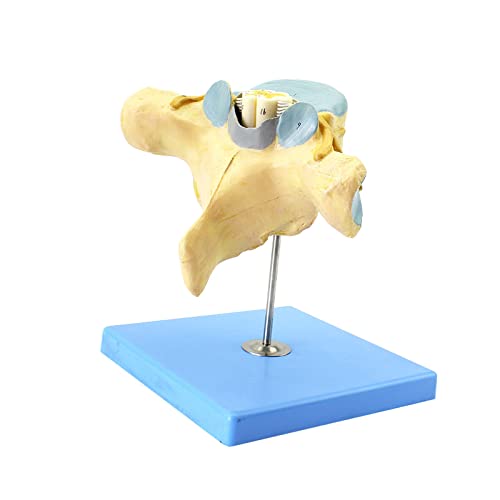 YHNNH, Vergrößertes Modell menschlicher Halswirbel mit Rückenmark und Spinalnerven. Neuro-Orthopädie, anatomisches Modell, Neuro-Orthopädie-Lehre YHNNH, Vergrößertes Modell menschlicher Halswirbel mit Rückenmark und Spinalnerven. Neuro-Orthopädie, anatomisches Modell, Neuro-Orthopädie-Lehre von YHNNH
