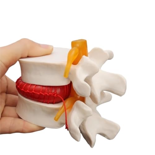 Gelb/weißes anatomisches Modell der menschlichen Bandscheibe, 10 x 10 cm, lebensgroßes Wirbelsäulenskelett, Skelettmodell for Selbermachen, 1 Stück(White) von YJQHODY