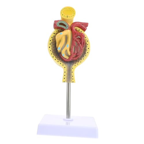 YOSADIER 1 Stück Human Glomerulus Anatomisches Modell mit Basis Lehrmittel für Physiologie Umweltfreundliches Material für Medizinische Ausbildung Anschauliche Präsentationen YOSADIER 1 Stück Human Glomerulus Anatomisches Modell mit Basis Lehrmittel für Physiologie Umweltfreundliches Material für Medizinische Ausbildung Anschauliche Präsentationen von YOSADIER