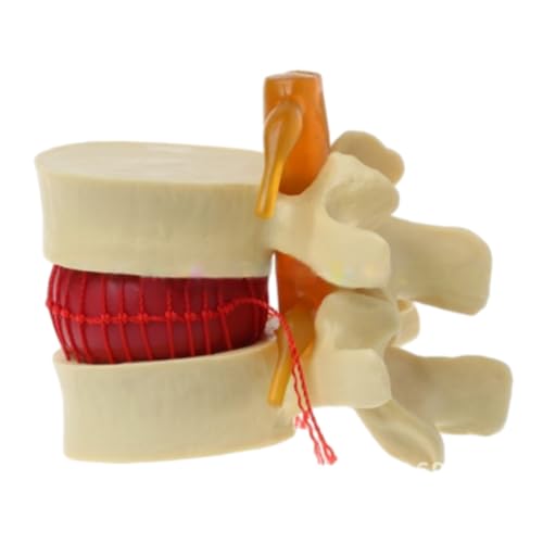 Zambuph Lendenwirbelmodell, anatomischer Bandscheibenvorfall, einfach zu verwendendes medizinisches Lehrmittel, medizinisches Requisitenmodell, PVC, Gelb Zambuph Lendenwirbelmodell, anatomischer Bandscheibenvorfall, einfach zu verwendendes medizinisches Lehrmittel, medizinisches Requisitenmodell, PVC, Gelb von Zambuph