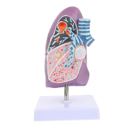 Zerodeko Lungenmodellunterrichtshilfen Modell der Lungenanatomie Anatomiemodell Modell der rauchenden Lunge Lungenmodell für den Unterricht Lungenmodell für die Ausbildung Plastik Zerodeko Lungenmodellunterrichtshilfen Modell der Lungenanatomie Anatomiemodell Modell der rauchenden Lunge Lungenmodell für den Unterricht Lungenmodell für die Ausbildung Plastik von Zerodeko