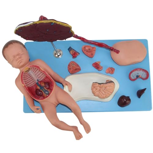 buyzg Anatomisches Modell der Eingeweide von Neugeborenen, abnehmbar, 13 Teile, mit abnehmbarem Fötus, Nabelschnur und Plazenta für die Ausbildung in menschlicher Anatomie und Physiologie buyzg Anatomisches Modell der Eingeweide von Neugeborenen, abnehmbar, 13 Teile, mit abnehmbarem Fötus, Nabelschnur und Plazenta für die Ausbildung in menschlicher Anatomie und Physiologie von buyzg