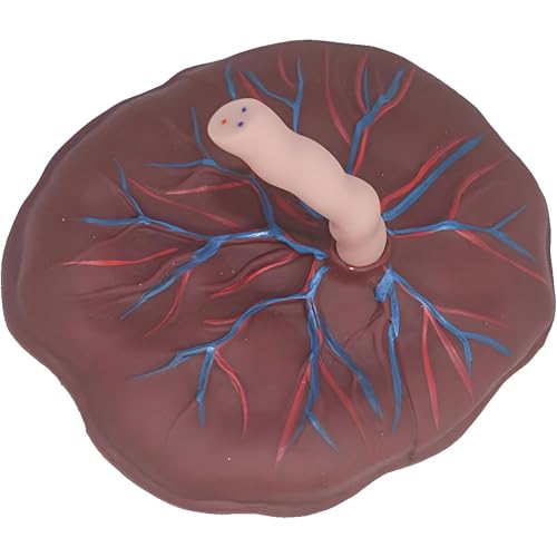 buyzg Anatomisches Modell der Plazenta und Nabelschnur für die gynäkologische Ausbildung, mit detaillierter Darstellung von Venen und Arterien für die Neugeborenenpflege buyzg Anatomisches Modell der Plazenta und Nabelschnur für die gynäkologische Ausbildung, mit detaillierter Darstellung von Venen und Arterien für die Neugeborenenpflege von buyzg
