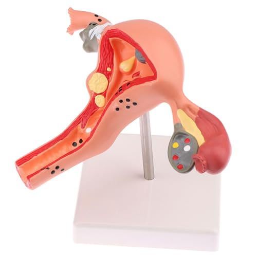 buyzg Anatomisches Modell der weiblichen Gebärmutter und Eierstöcke, detailliertes Lehrmittel für die Pathologie zur Dissektion der menschlichen reproduktiven Gesundheit und Krankheiten buyzg Anatomisches Modell der weiblichen Gebärmutter und Eierstöcke, detailliertes Lehrmittel für die Pathologie zur Dissektion der menschlichen reproduktiven Gesundheit und Krankheiten von buyzg