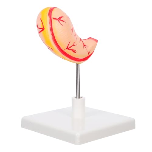 iplusmile Detailliertes Magenmodell für Medizinstudenten und Fachkräfte Realistisches Anatomie Modell Des Menschlichen Magens Robustes Lehrmodell für Biologie und Physiologie Lernen von iplusmile
