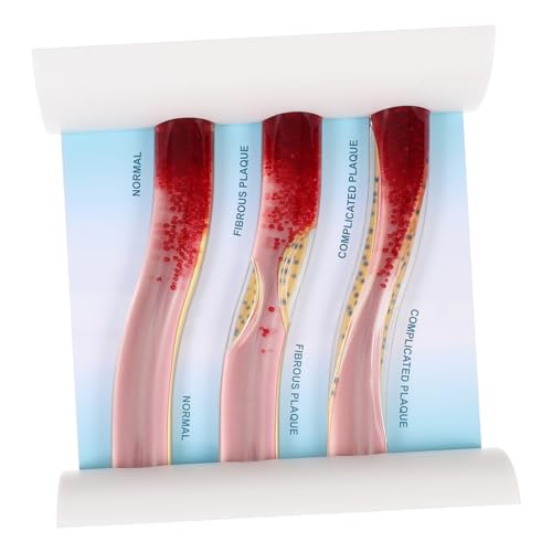 iplusmile Dynamisches Blutgefäßmodell aus Anatomisches Modell zur Veranschaulichung von Krankheitsverläufen Gesunden Blutgefäßen für Medizinische Ausbildung iplusmile Dynamisches Blutgefäßmodell aus Anatomisches Modell zur Veranschaulichung von Krankheitsverläufen Gesunden Blutgefäßen für Medizinische Ausbildung von iplusmile