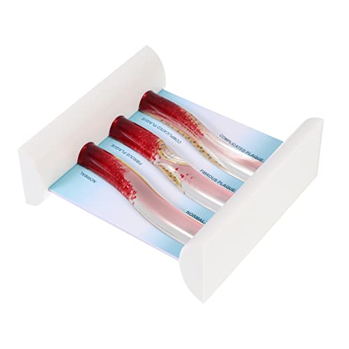 iplusmile Hochwertiges Gefäßmodell mit Demonstration Modellanatomie Zum Lernen & Lehren iplusmile Hochwertiges Gefäßmodell mit Demonstration Modellanatomie Zum Lernen & Lehren von iplusmile