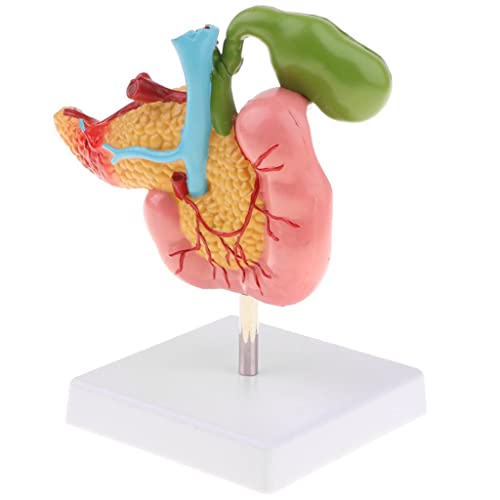 misppro 1:1 Bauchspeicheldrüse Duodenum Gallenblase Pathologische Anatomie Modell, 17 x 10 x 18 cm von misppro
