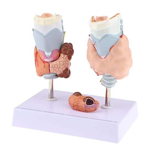 Vergrößertes menschliches Schilddrüsenmodell für normale und pathologische Organe, mit Basis für Anatomiestudium, 17,5 x 12,5 x 18 cm Vergrößertes menschliches Schilddrüsenmodell für normale und pathologische Organe, mit Basis für Anatomiestudium, 17,5 x 12,5 x 18 cm von pistro
