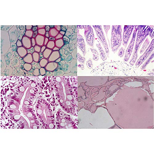 Dauerpräparate für Mikroskop Prepared Microscope Slides 25 Stücke Biologie Glas Präparierte Objektträger Lab Proben für Grundlegende Biologische Wissenschaft Bildung mit Box von tooloflife